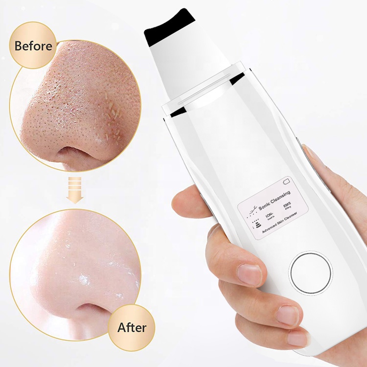 Produits de beauté électrique en Silicone Peeling du visage Led exfoliant Facial coréen ultrasons peau spatule épurateur brume peau épurateur – Image 6